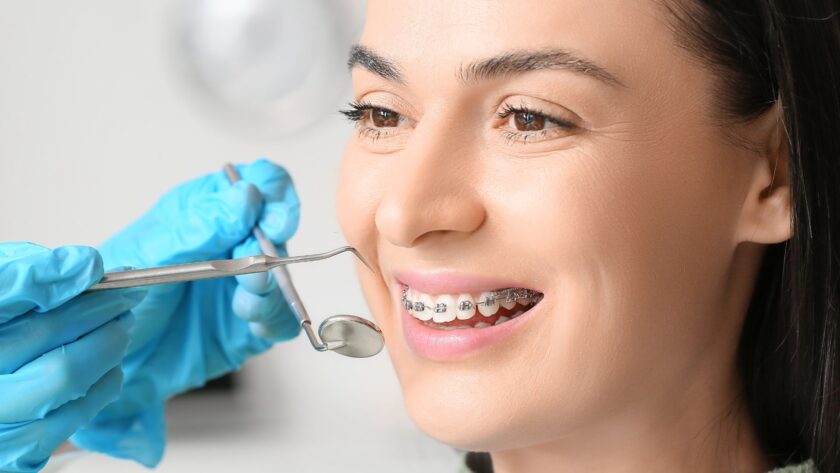 Invisalign treatment in Agoura Hills